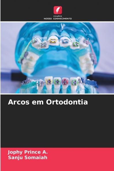 Arcos em Ortodontia