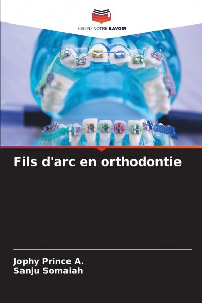 Fils d'arc en orthodontie