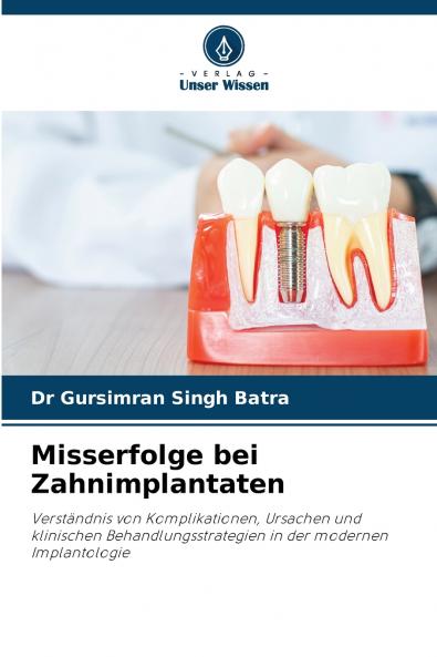 Misserfolge bei Zahnimplantaten