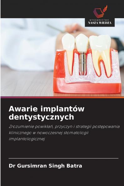 Awarie implantów dentystycznych