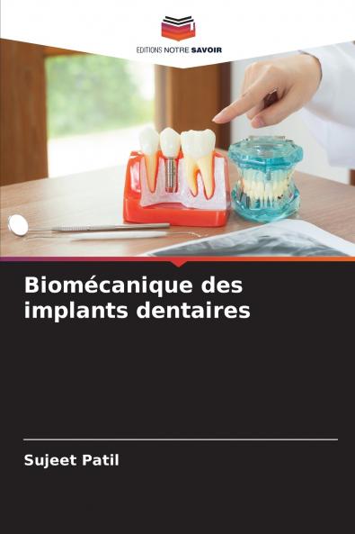 Biomécanique des implants dentaires