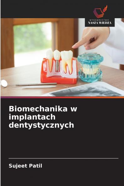 Biomechanika w implantach dentystycznych