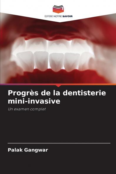 Progrès de la dentisterie mini-invasive