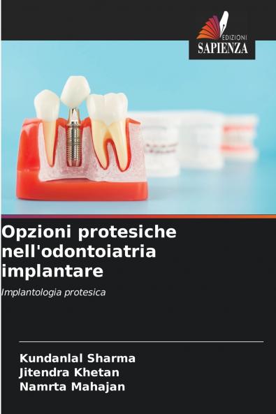 Opzioni protesiche nell'odontoiatria implantare