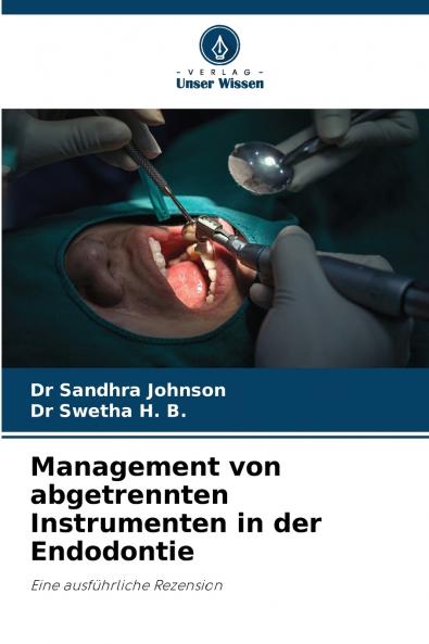 Management von abgetrennten Instrumenten in der Endodontie