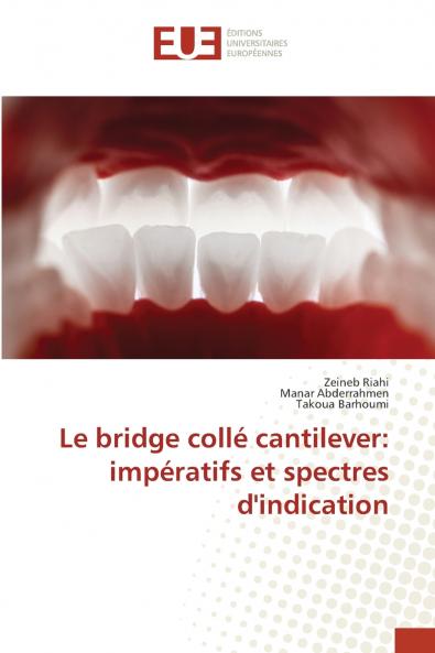 Le bridge collé cantilever