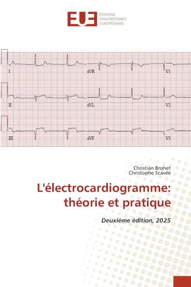 L'électrocardiogramme