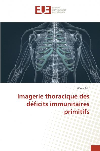 Imagerie thoracique des déficits immunitaires primitifs
