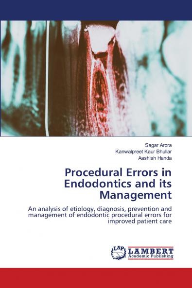 Procedural Errors in Endodontics and its Management