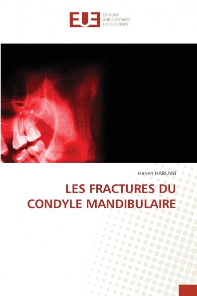 LES FRACTURES DU CONDYLE MANDIBULAIRE