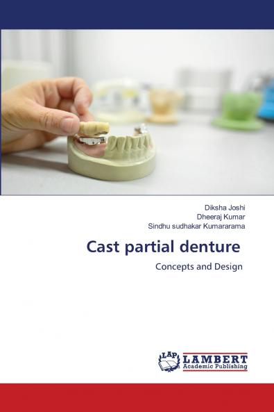 Cast partial denture