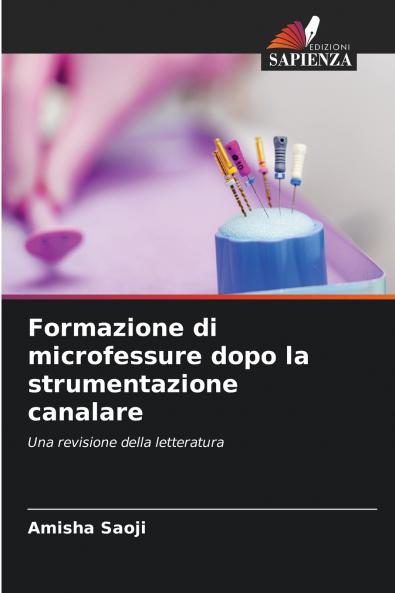 Formazione di microfessure dopo la strumentazione canalare