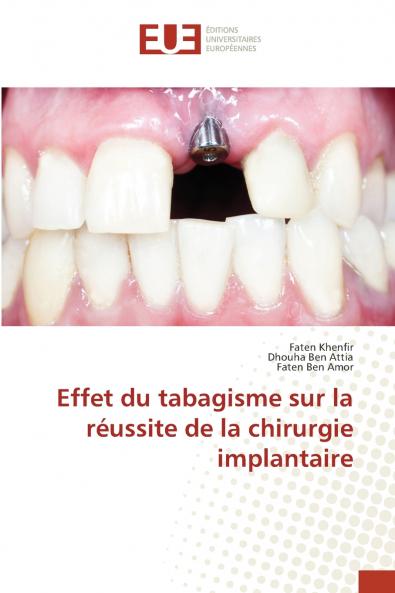 Effet du tabagisme sur la réussite de la chirurgie implantaire