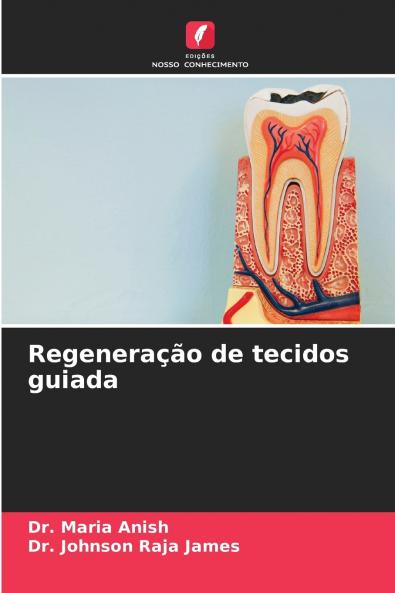 Regeneração de tecidos guiada