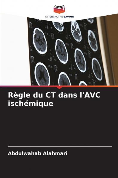Règle du CT dans l'AVC ischémique