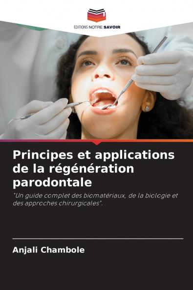 Principes et applications de la régénération parodontale