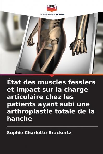 État des muscles fessiers et impact sur la charge articulaire chez les patients ayant subi une arthroplastie totale de la hanche