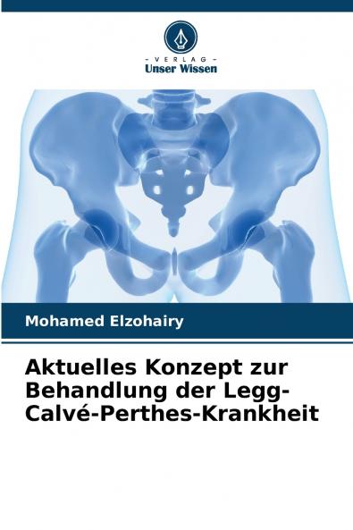 Aktuelles Konzept zur Behandlung der Legg-Calvé-Perthes-Krankheit