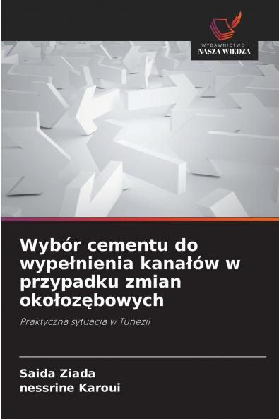 Wybór cementu do wypełnienia kanałów w przypadku zmian okołozębowych
