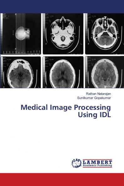 Medical Image Processing Using IDL