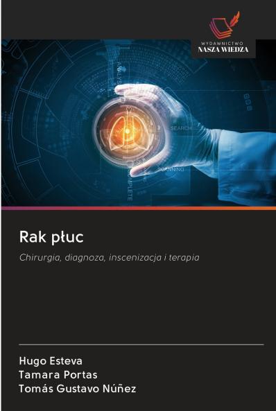 Rak p?uc