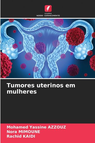 Tumores uterinos em mulheres