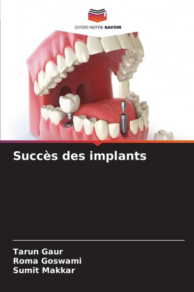 Succès des implants