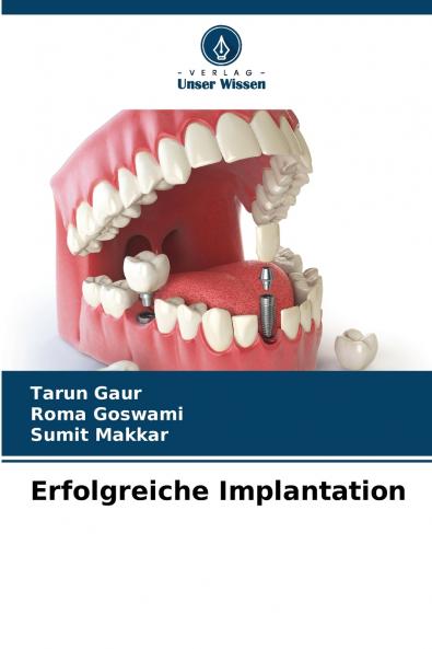 Erfolgreiche Implantation
