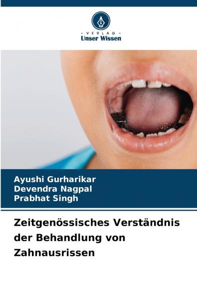 Zeitgenössisches Verständnis der Behandlung von Zahnausrissen