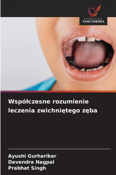 Wspó?czesne rozumienie leczenia zwichni?tego z?ba