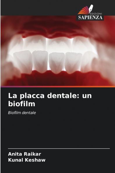 La placca dentale