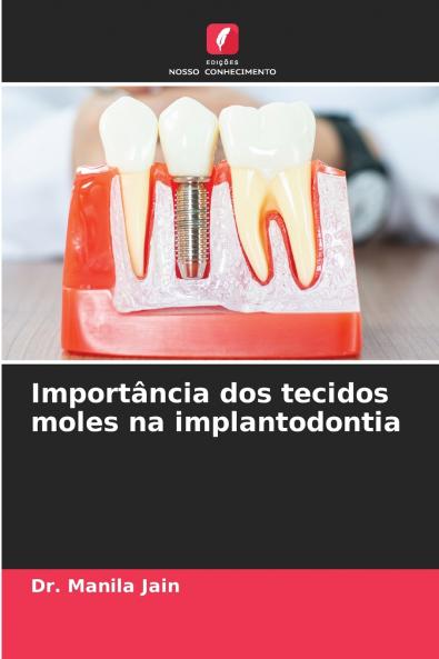 Importância dos tecidos moles na implantodontia