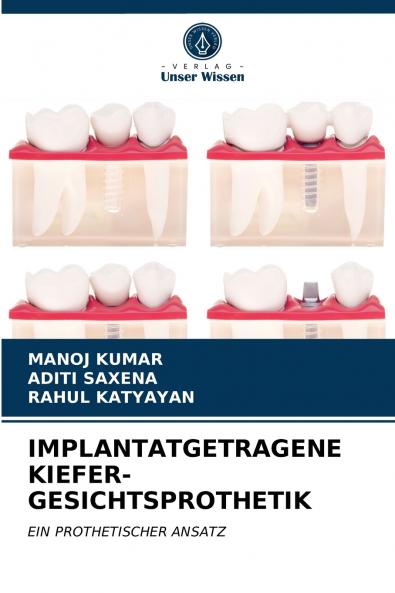 IMPLANTATGETRAGENE KIEFER-GESICHTSPROTHETIK