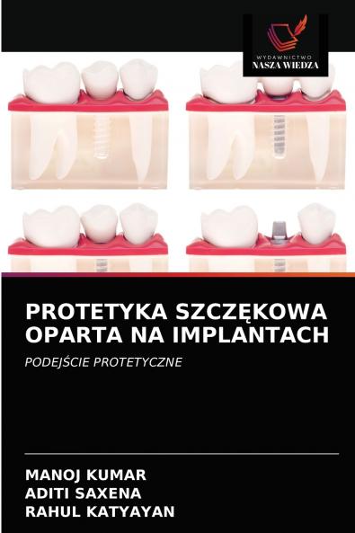 PROTETYKA SZCZ?KOWA OPARTA NA IMPLANTACH