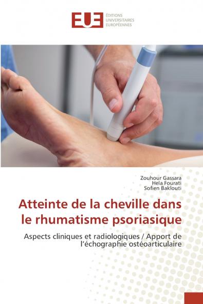 Atteinte de la cheville dans le rhumatisme psoriasique