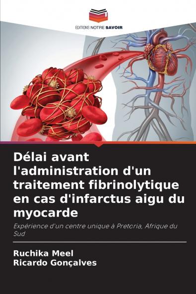 Délai avant l'administration d'un traitement fibrinolytique en cas d'infarctus aigu du myocarde