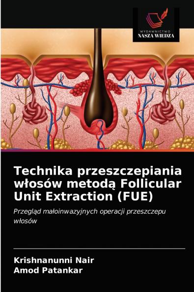 Technika przeszczepiania w?osów metod? Follicular Unit Extraction (FUE)