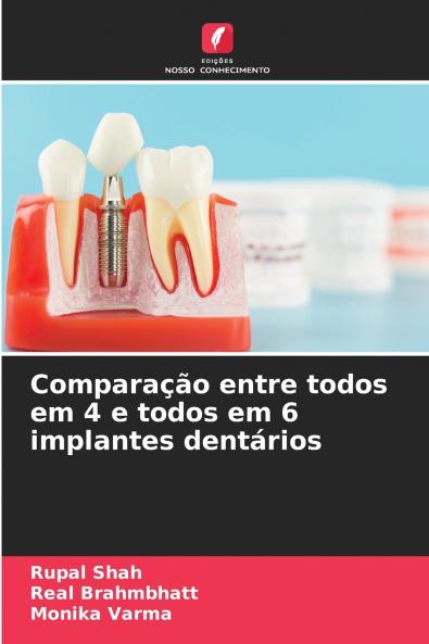 Comparação entre todos em 4 e todos em 6 implantes dentários
