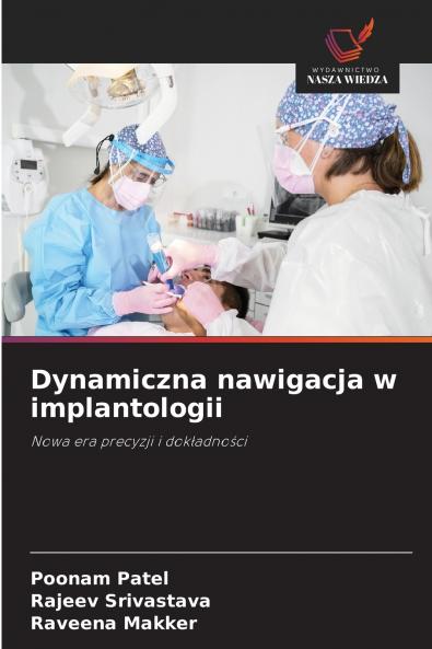 Dynamiczna nawigacja w implantologii
