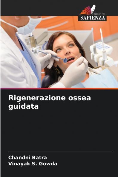 Rigenerazione ossea guidata