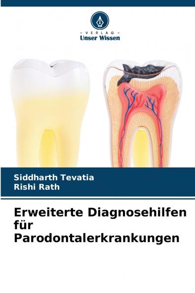 Erweiterte Diagnosehilfen für Parodontalerkrankungen