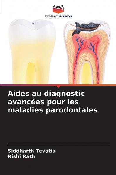 Aides au diagnostic avancées pour les maladies parodontales