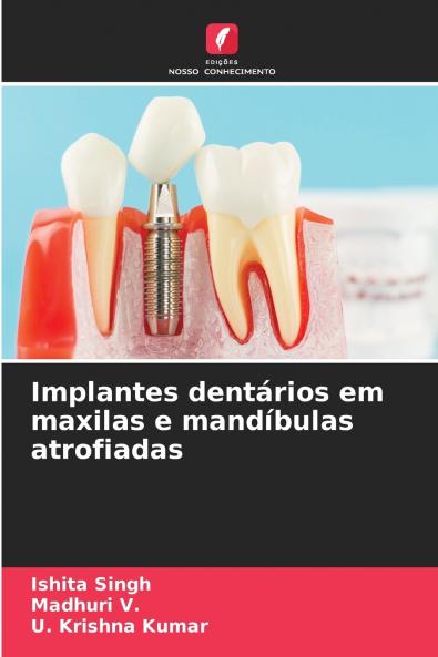 Implantes dentários em maxilas e mandíbulas atrofiadas