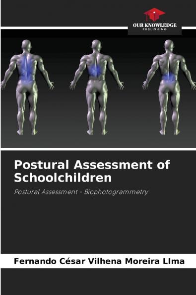 Postural Assessment of Schoolchildren