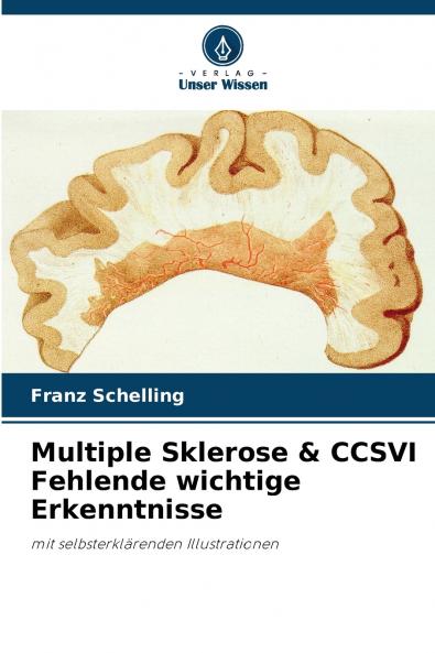 Multiple Sklerose & CCSVI Fehlende wichtige Erkenntnisse