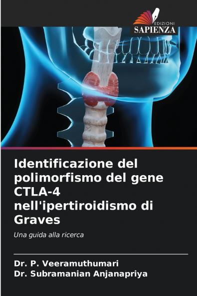 Identificazione del polimorfismo del gene CTLA-4 nell'ipertiroidismo di Graves
