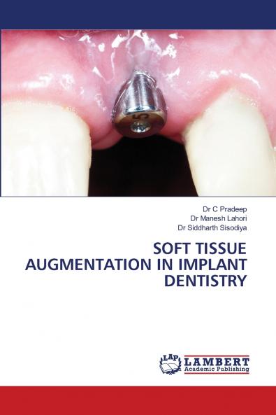 SOFT TISSUE AUGMENTATION IN IMPLANT DENTISTRY