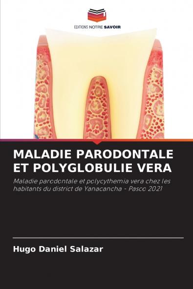MALADIE PARODONTALE ET POLYGLOBULIE VERA