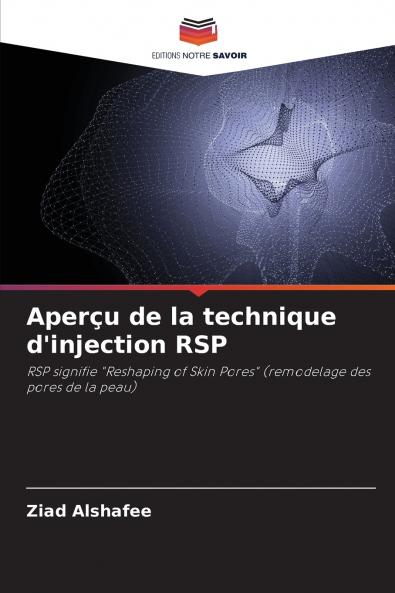Aperçu de la technique d'injection RSP