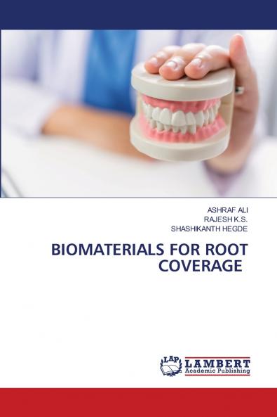 BIOMATERIALS FOR ROOT COVERAGE